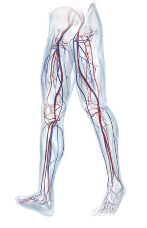 thrombose